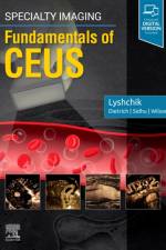 Specialty Imaging: Fundamentals of CEUS af Andrej Lyshchik