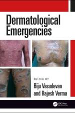 Dermatological Emergencies