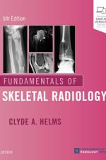 Fundamentals of Skeletal Radiology af Clyde A. (Professor of Radiology and Orthopaedic Surgery Helms