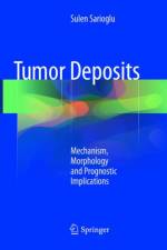Tumor Deposits af Sulen Sarioglu