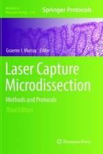 Laser Capture Microdissection