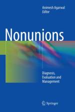 Nonunions