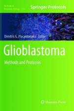 Glioblastoma