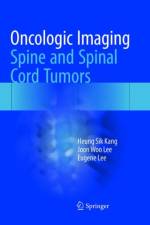 Oncologic Imaging: Spine and Spinal Cord Tumors af Heung Sik Kang