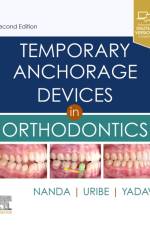 Temporary Anchorage Devices in Orthodontics