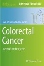 Colorectal Cancer