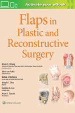 Flaps in Plastic and Reconstructive Surgery