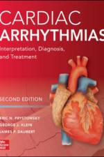 Cardiac Arrhythmias: Interpretation, Diagnosis and Treatment, Second Edition af Eric N. Prystowsky