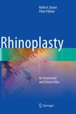 Rhinoplasty af Rollin K. Daniel