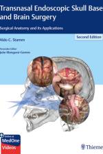 Transnasal Endoscopic Skull Base and Brain Surgery