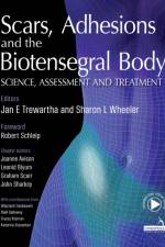 Scars, Adhesions and the Biotensegral Body af Jan Trewartha