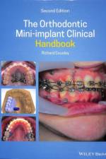 The Orthodontic Mini-implant Clinical Handbook af Richard (Consultant Orthodontist for the Peterborough