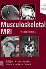 Musculoskeletal MRI af Nancy M. (Professor of Radiology and Orthopedics Major