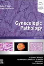 Gynecologic Pathology af Marisa R. (Vice Chair and Director Nucci