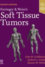 Enzinger and Weiss's Soft Tissue Tumors af Sharon W. (Professor of Pathology and Laboratory Medicine Weiss
