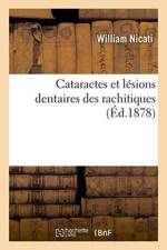 Cataractes Et Lesions Dentaires Des Rachitiques af William Nicati