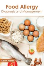 Food Allergy: Diagnosis and Management