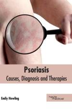 Psoriasis: Causes, Diagnosis and Therapies