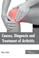 Causes, Diagnosis and Treatment of Arthritis