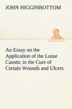 Essay on the Application of the Lunar Caustic in the Cure of Certain Wounds and Ulcers af John Higginbottom