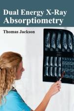 Dual Energy X-Ray Absorptiometry