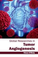 Global Researches in Tumor Angiogenesis