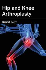 Hip and Knee Arthroplasty
