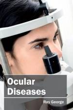 Ocular Diseases