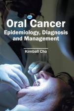 Oral Cancer: Epidemiology, Diagnosis and Management