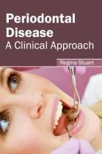 Periodontal Disease: A Clinical Approach