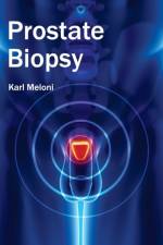 Prostate Biopsy