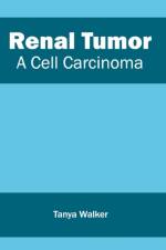 Renal Tumor: A Cell Carcinoma