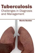 Tuberculosis: Challenges in Diagnosis and Management