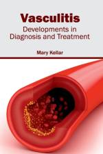 Vasculitis: Developments in Diagnosis and Treatment
