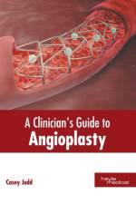 Clinician's Guide to Angioplasty
