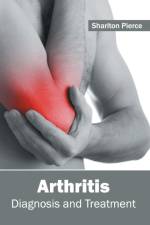 Arthritis: Diagnosis and Treatment