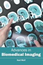 Advances in Biomedical Imaging