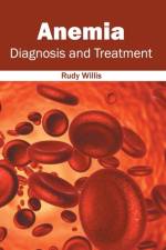 Anemia: Diagnosis and Treatment