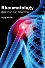 Rheumatology: Diagnosis and Treatment