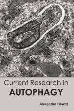 Current Research in Autophagy