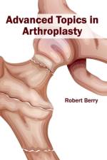 Advanced Topics in Arthroplasty