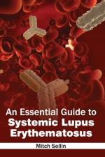 Essential Guide to Systemic Lupus Erythematosus