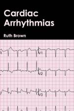Cardiac Arrhythmias