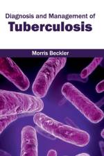 Diagnosis and Management of Tuberculosis
