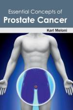 Essential Concepts of Prostate Cancer