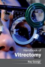 Handbook of Vitrectomy