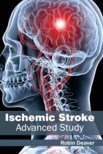 Ischemic Stroke: Advanced Study