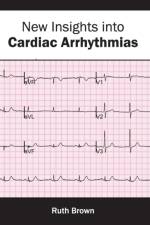 New Insights Into Cardiac Arrhythmias