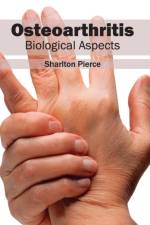 Osteoarthritis: Biological Aspects