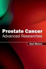Prostate Cancer: Advanced Researches